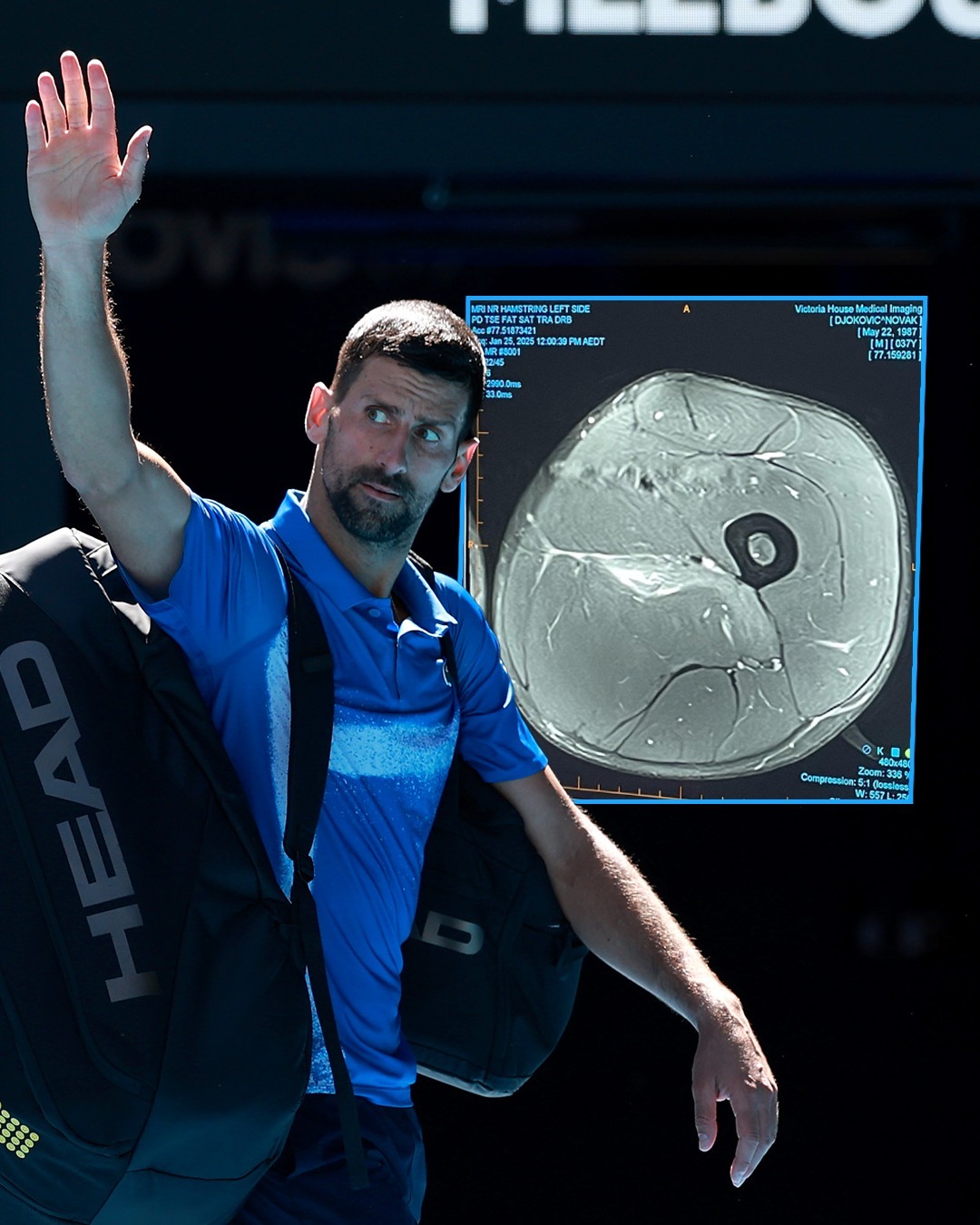 澳大利亚网球队险胜德国网球队，德约科维奇绝境逆转的简单介绍